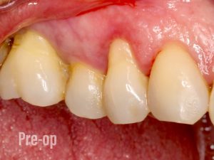 enc&iacute;as retra&iacute;das