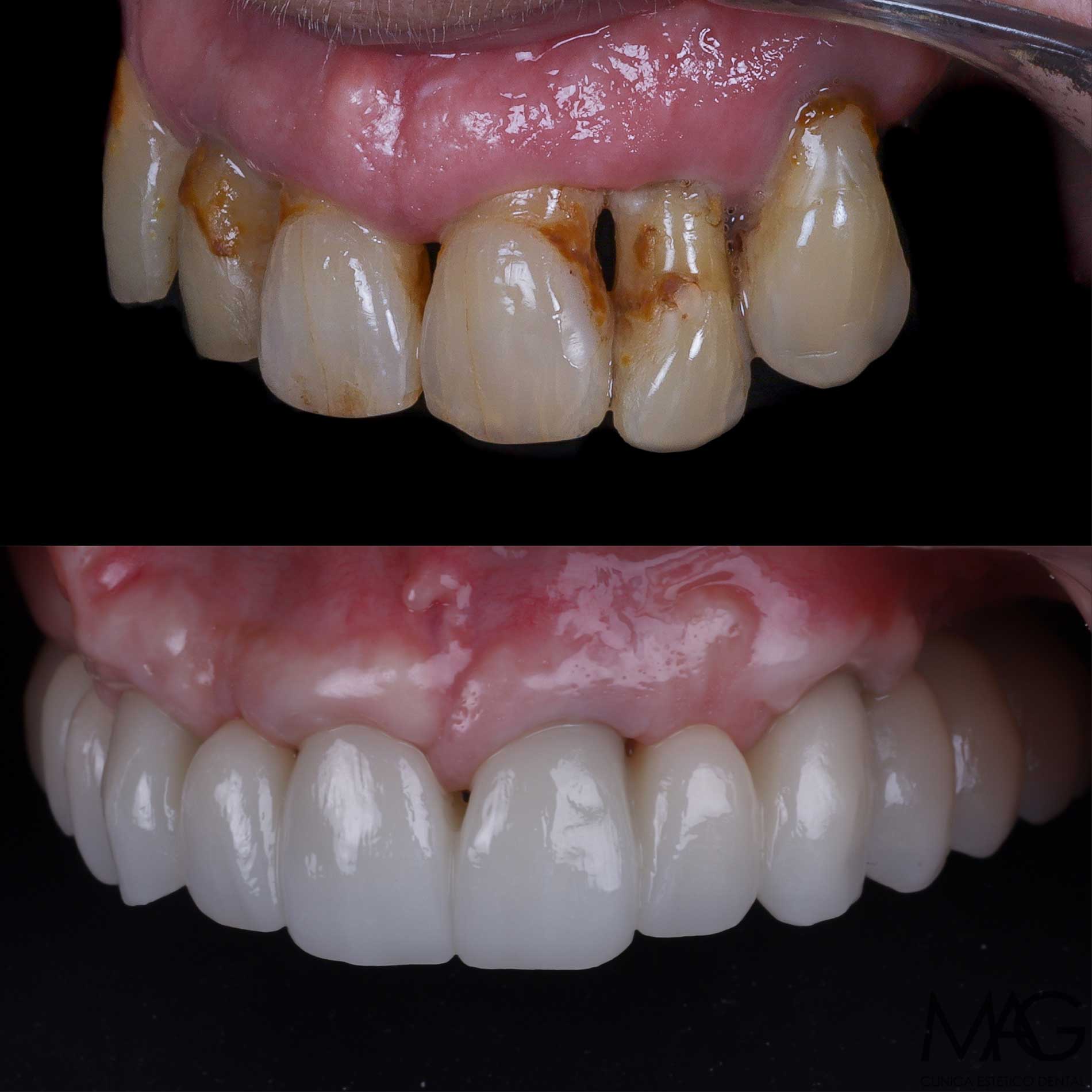 soluci&oacute;n de enfermedad periodontal